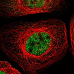 RBM5 Antibody, Novus Biologicals:Antibodies:Primary Antibodies